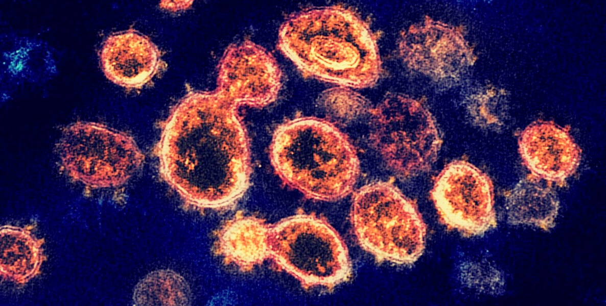 A predictor model shows coronavirus and the spread of the virus in different areas around the world.