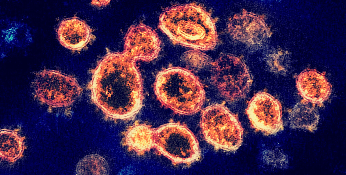 A predictor model shows coronavirus and the spread of the virus in different areas around the world.