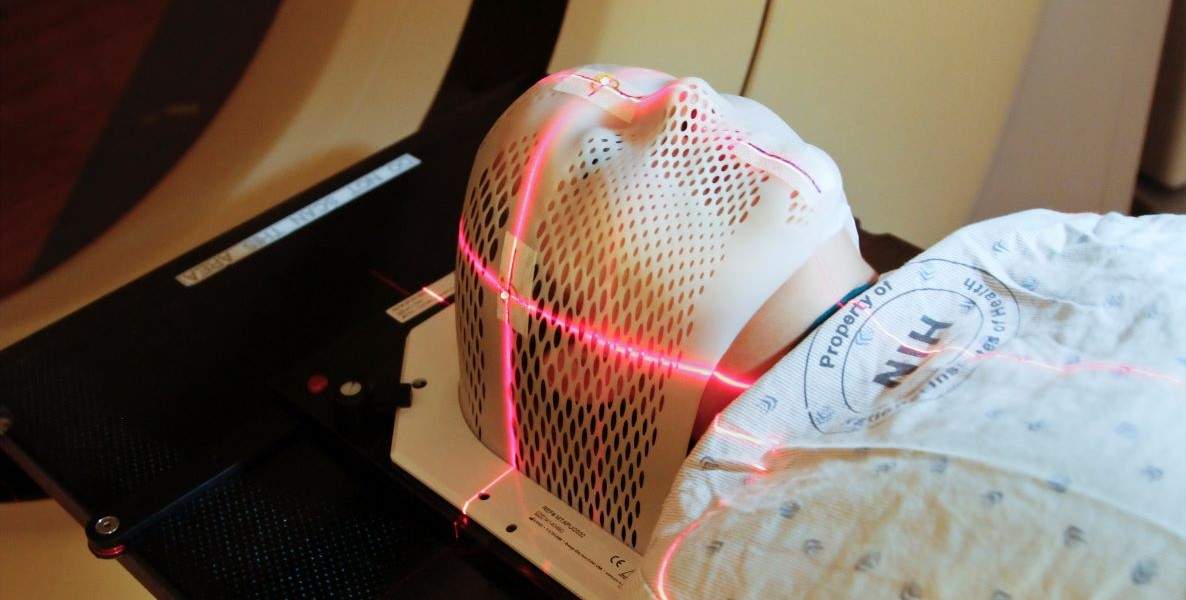 A woman receives a brain scan prior to radiation therapy